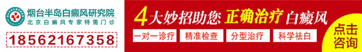 兰州中研白癜风医院